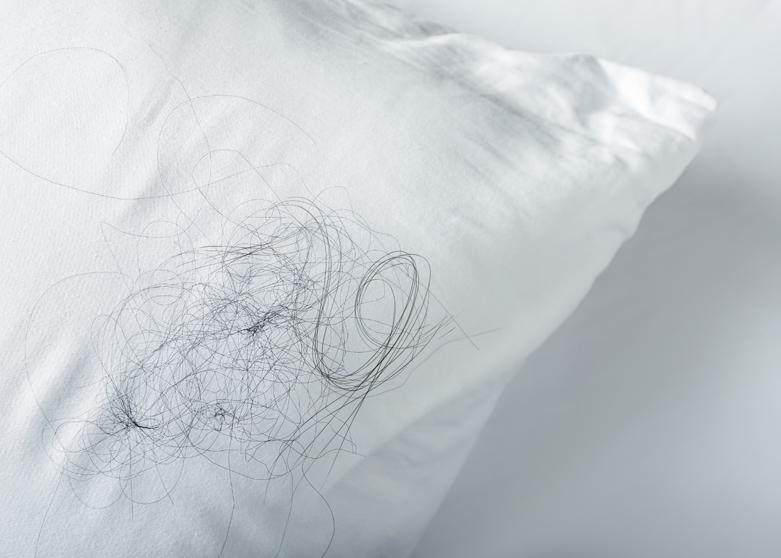 Excessive Shedding