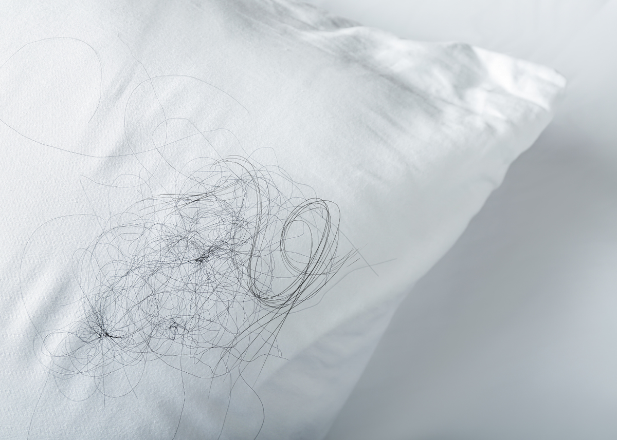 Excessive Shedding