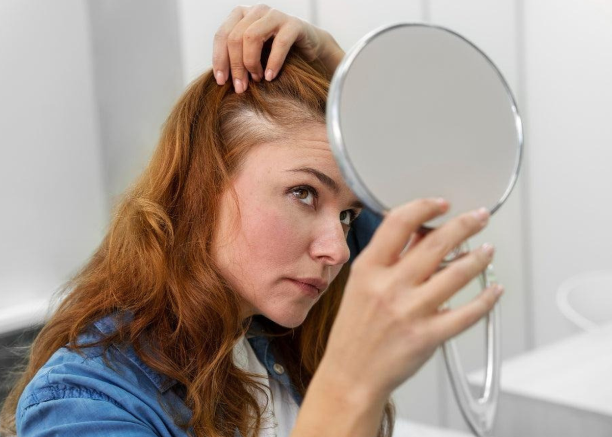 Female hair loss causes