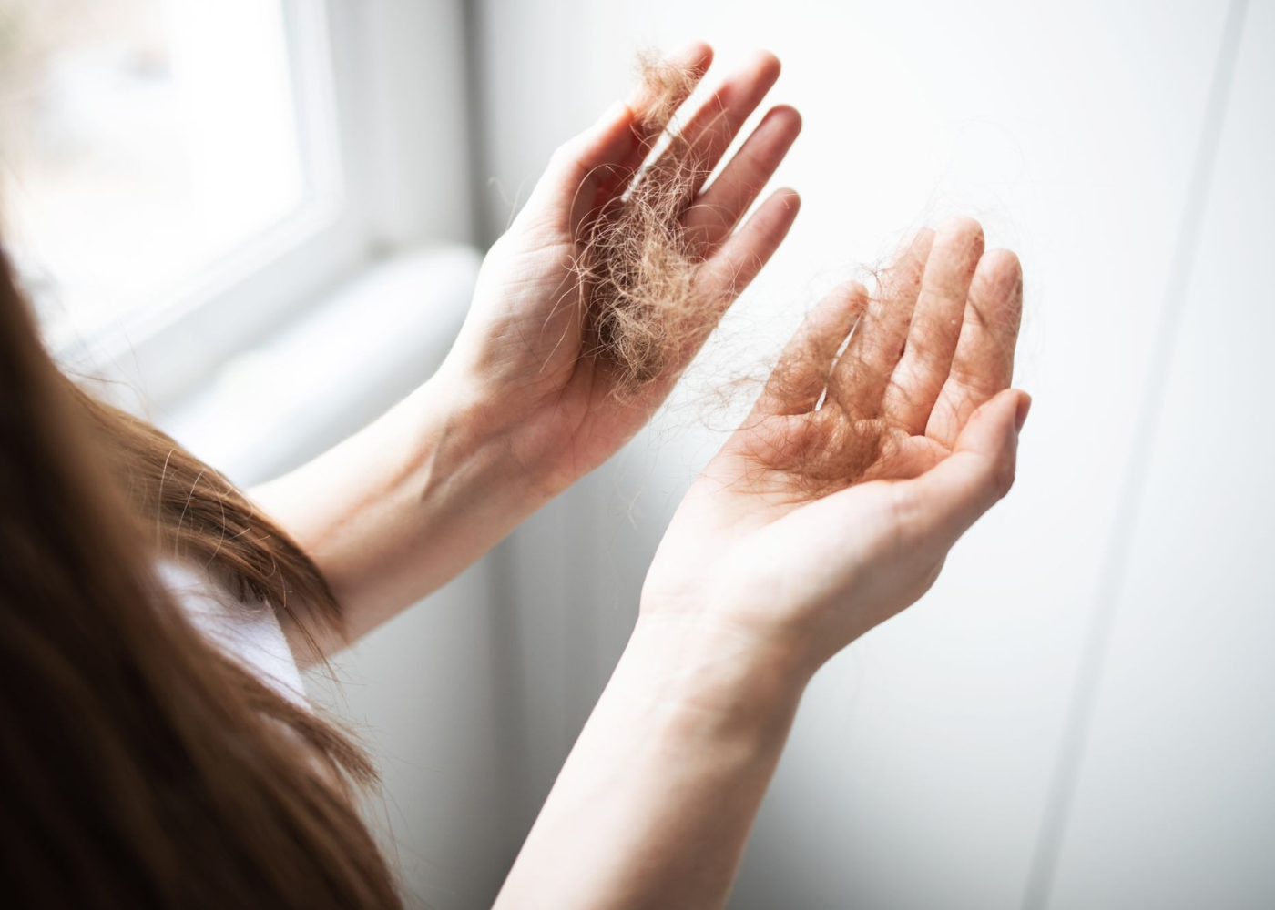 hair loss after weight loss
