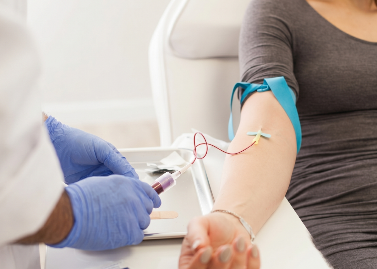 Hair Loss Blood Test