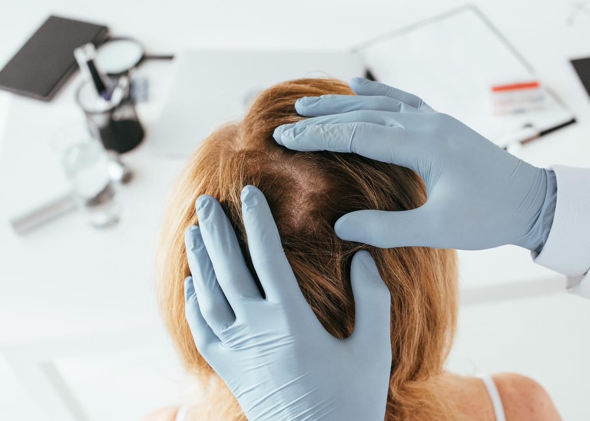 dermatologist for hair loss