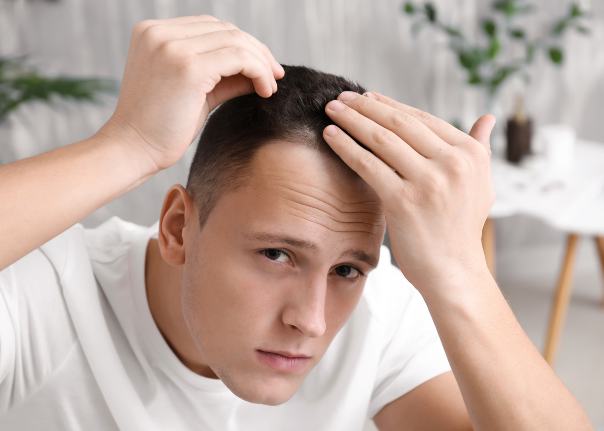 Male hair loss