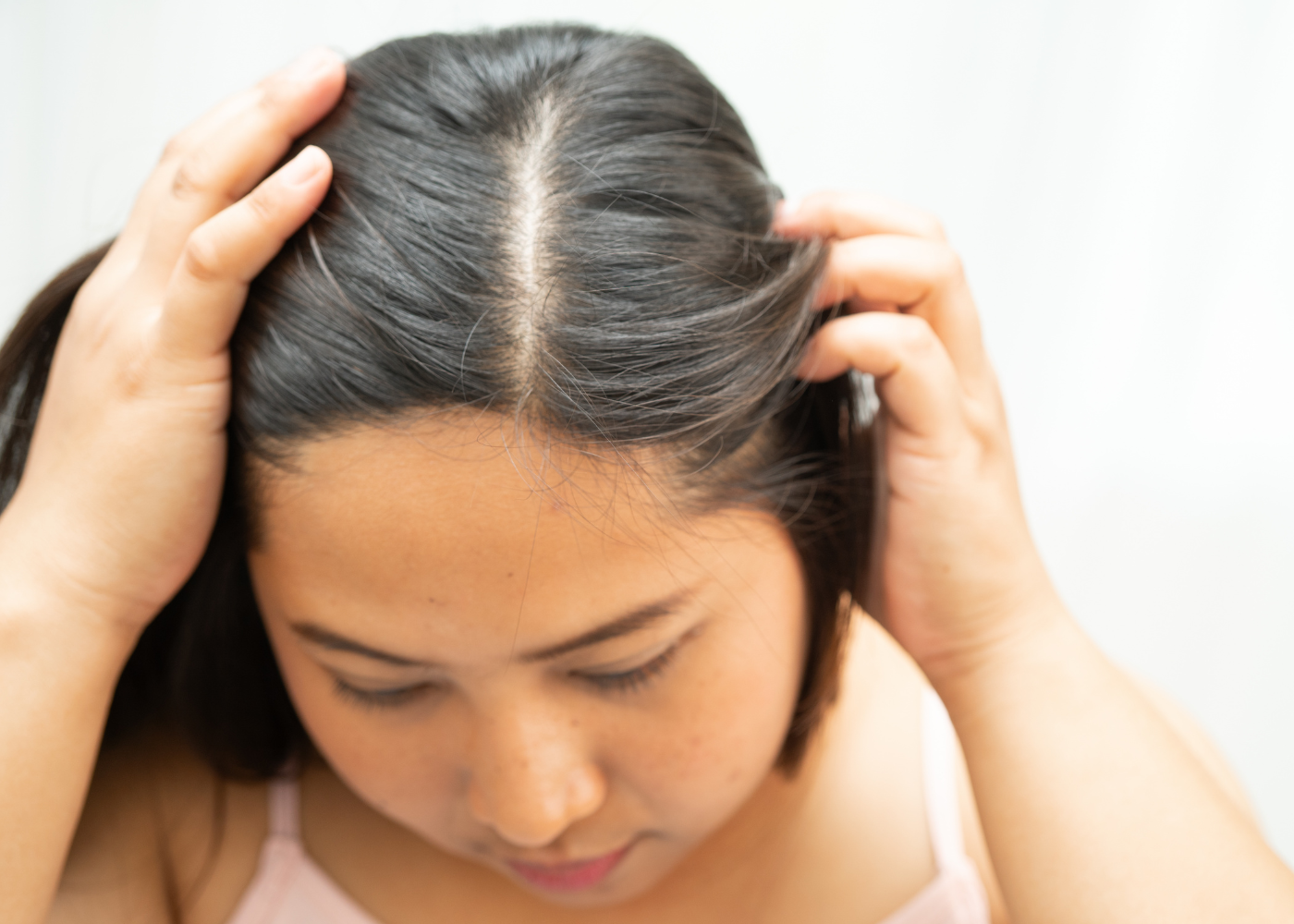 Itchy Scalp: Why It Happens and How to Soothe It