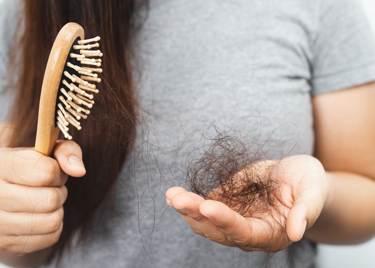Hypothyroidism and hair loss
