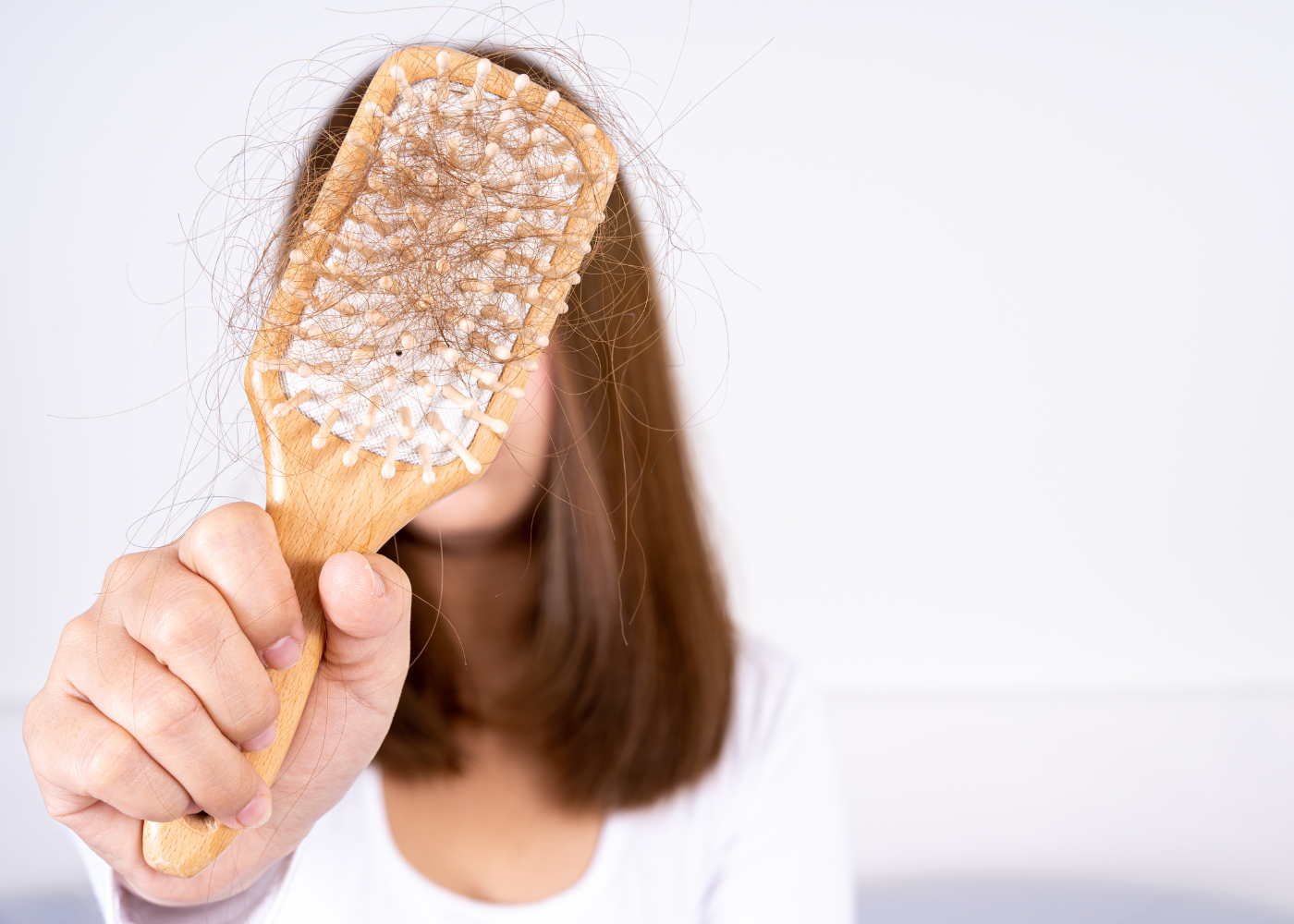 Androgenetic Alopecia